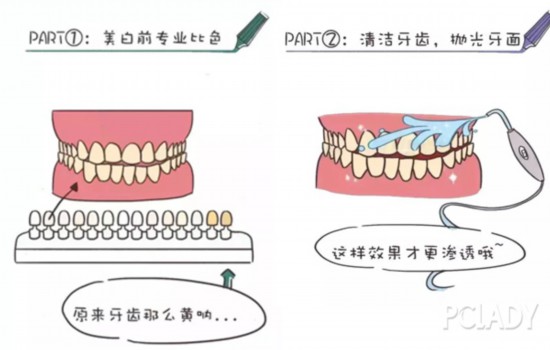 幾乎每個(gè)妹子都心動(dòng)的冷光美牙，你確定能做嗎？