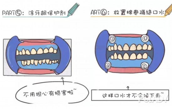 幾乎每個(gè)妹子都心動(dòng)的冷光美牙，你確定能做嗎？